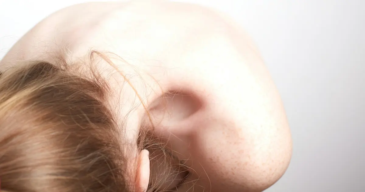 Cauliflower Ear Prevention in MMA: Gear, Habits, and Early Treatment